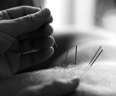 Dry needling/Akupunktur